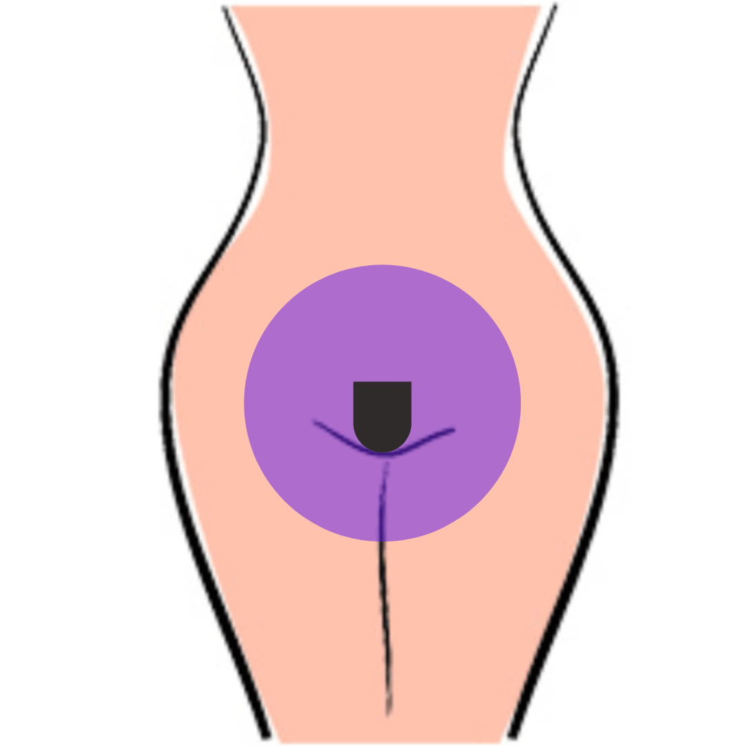 A pénisz intim területei, Erekció során a péniszből